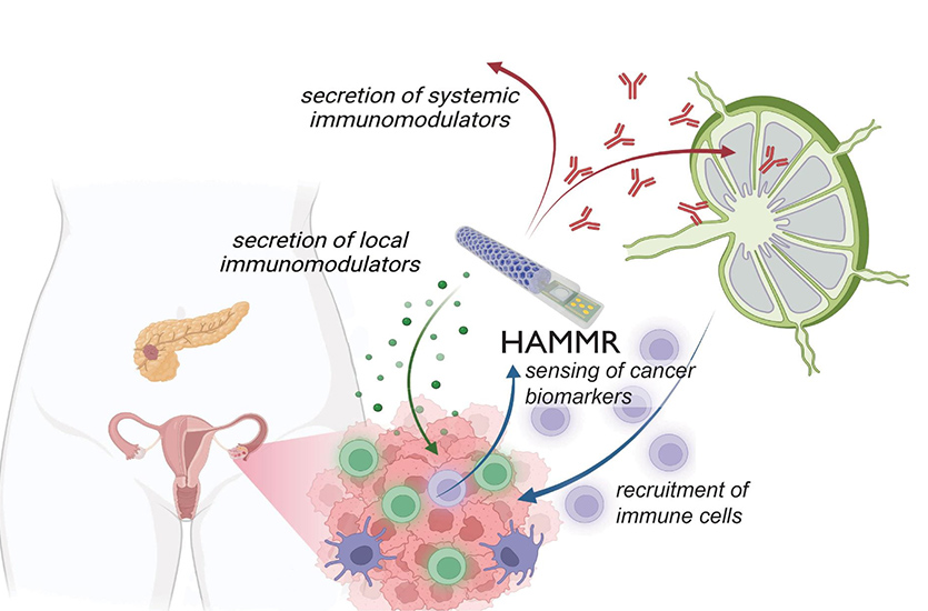 This figure illustrates a “closed-loop” implant, which will be used to treat recurrent ovarian cancer. Credit: Veiseh Lab/Rice University