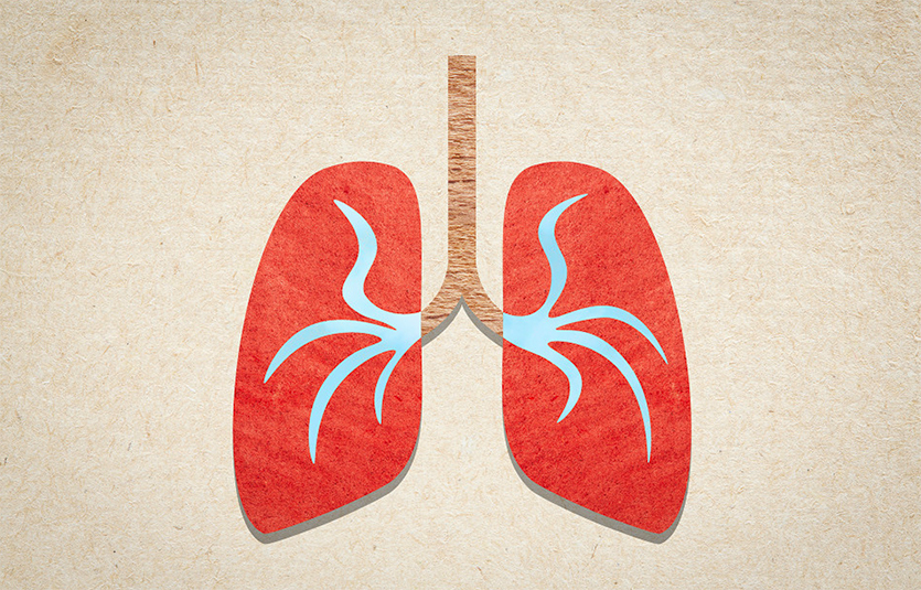 Using lung samples from pneumonia patients, researchers tracked how microbial ecosystems and immune responses evolved over time.