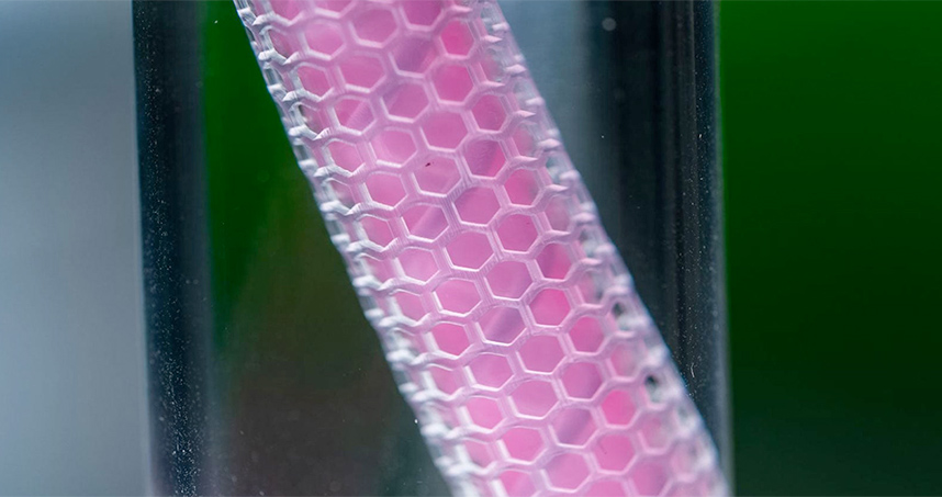 We are developing a small implant to sense inflammatory markers associated with cancer and autonomously deliver immunotherapy. Our goal: personalized therapy for cancer patients.